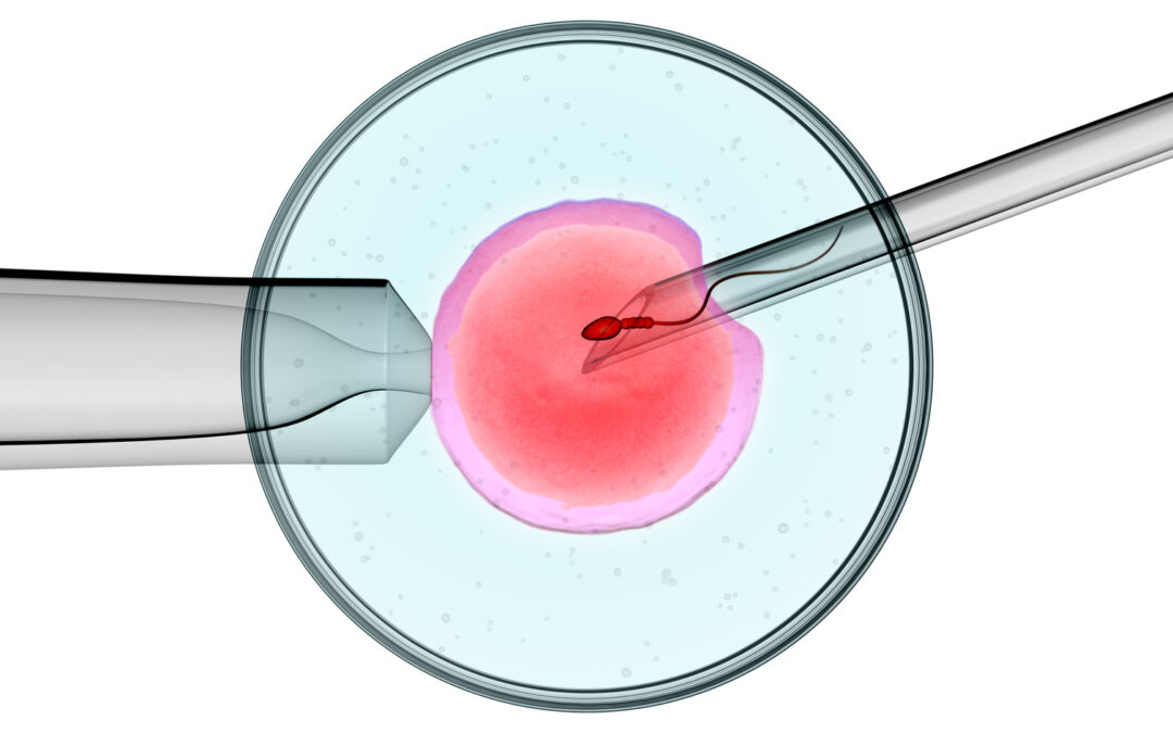 What is Intracytoplasmic Sperm Injection (ICSI)?